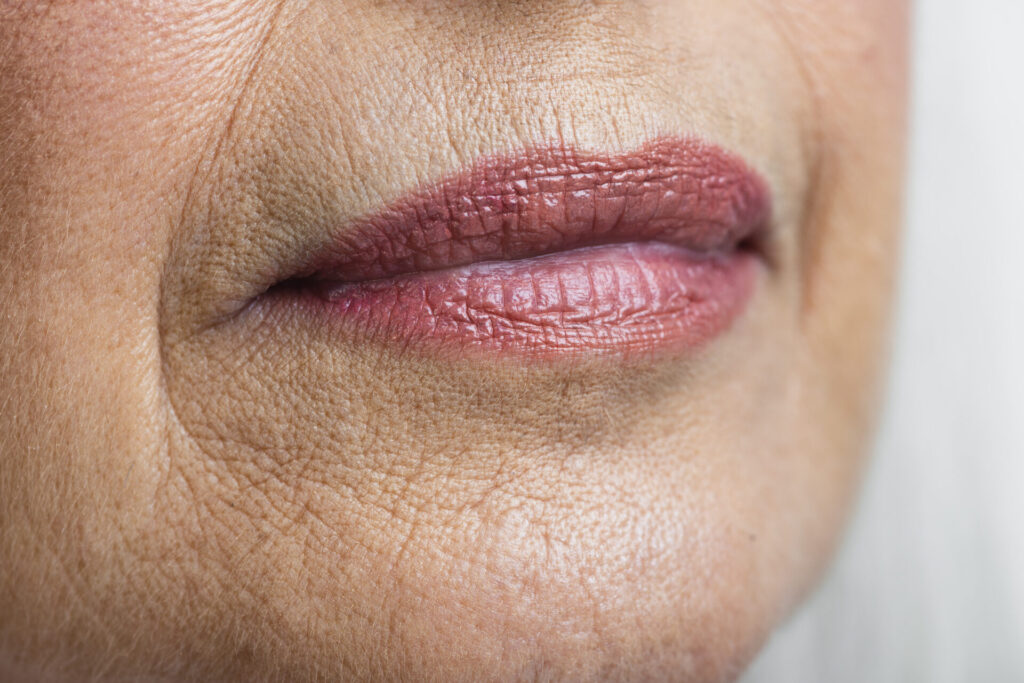 Immagine ritraente donna con rughe sulle labbra.